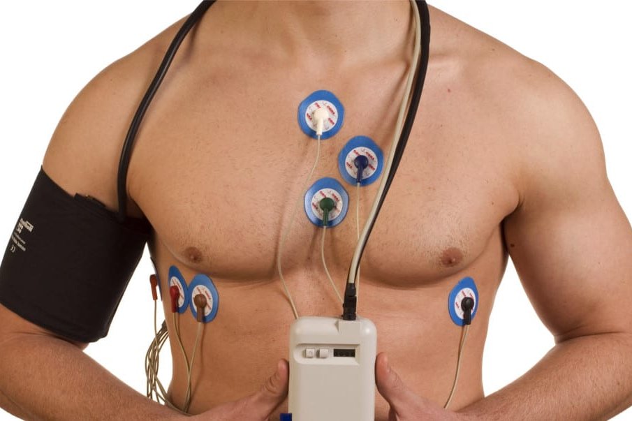 heart monitor implanted under skin