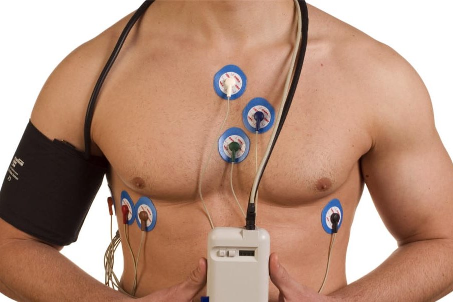 24 hour heart monitor